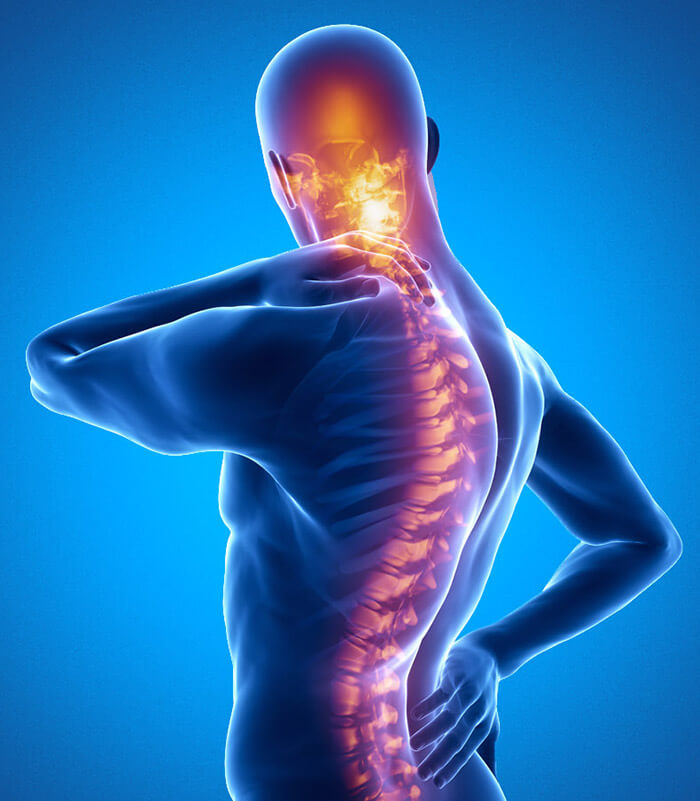 Spinal Compression Fracture